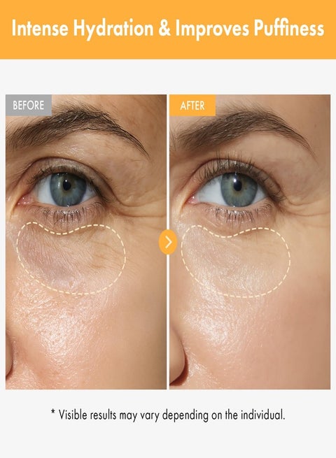 tosowoong glutathione serum is a key ingredient that I look for after going through breakouts & being left with darks spots…this being one of them😌💛 TOSOWOONG Arbutin 7% + Tranexamic