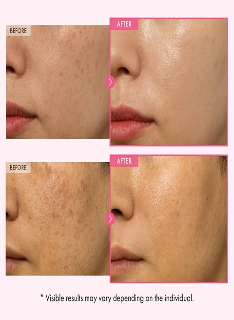 glutathione injections skin whitening near me Glutathione Injections In Katy