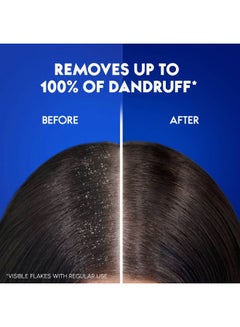 Head & Shoulders Daily Clean Anti-Dandruff Shampoo For Normal Hair Clear 200ml  - Image 5