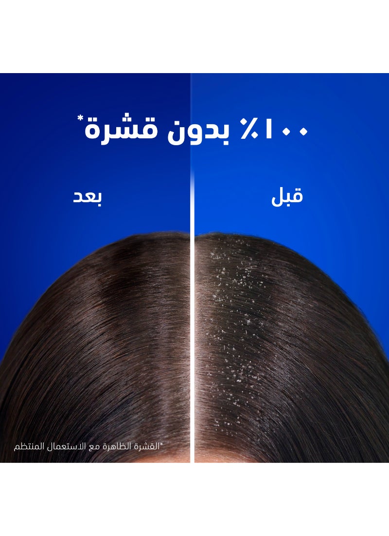Head & Shoulders Smooth And Silky Anti Dandruff Shampoo From Root To Tip 1Liters - Image 2