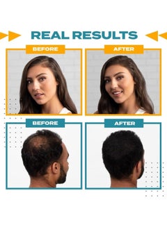 Toppik Hairline Optimizer - Professional Tool Kit Black  - Image 5