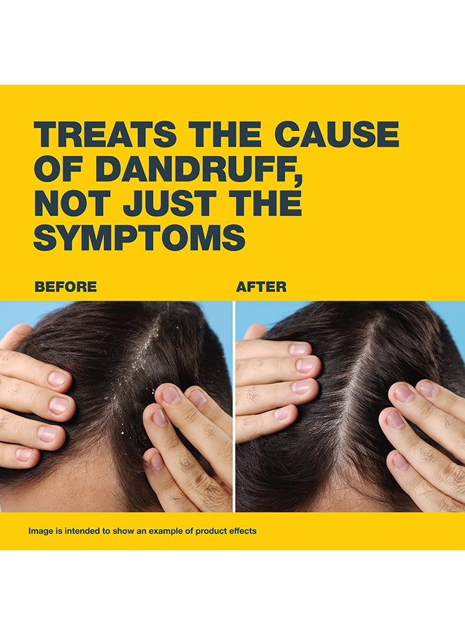 نيزورال شامبو للشعر ضد القشرة 100ملليلتر - Image 3