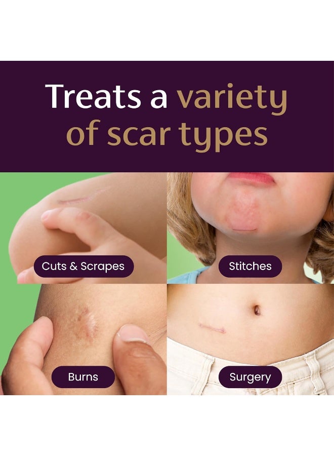 Mederma Skin Care Cream For Scars Purple - Image 4