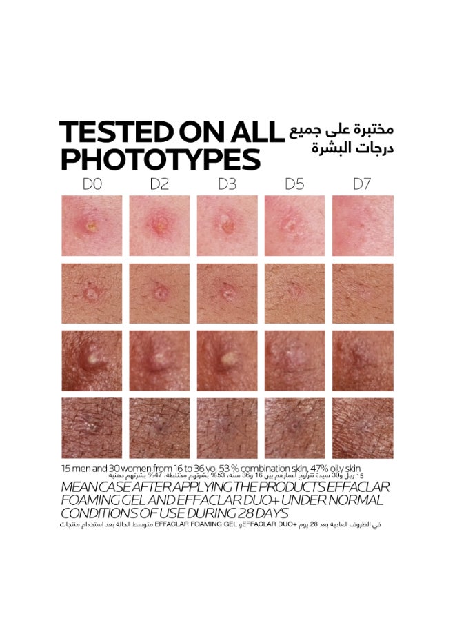 لاروش بوزيه إيفاكلار دوو+ كريم لعلاج حب الشباب 40ملليلتر - Image 4