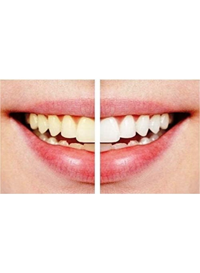 InstaWhite Instant Whitening Pen - Image 2