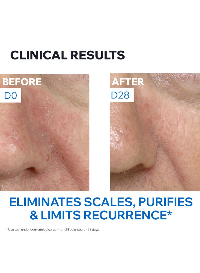 Uriage DS Regulating Soothing Emulsion with TLR2-Regul Complex - Anti-Redness Face Care - 40ml 40ml - Image 5