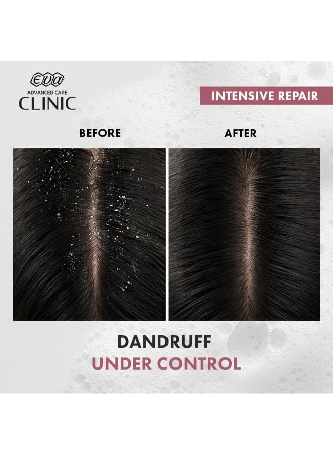 e Keratin Clinic Intensive Repair Anti-dandruff Shampoo with Keratin & Tea Tree Oil for Damaged Hair 230ml - Image 4