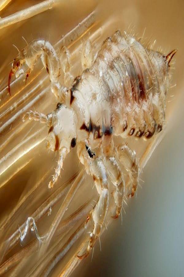 بارانيكس بخاّخ لعلاج قمل الرأس وبيضه - Image 2