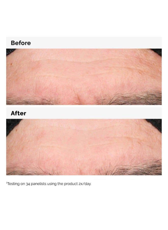 The Ordinary Hyaluronic Acid 2% + B5 30ml - Image 5