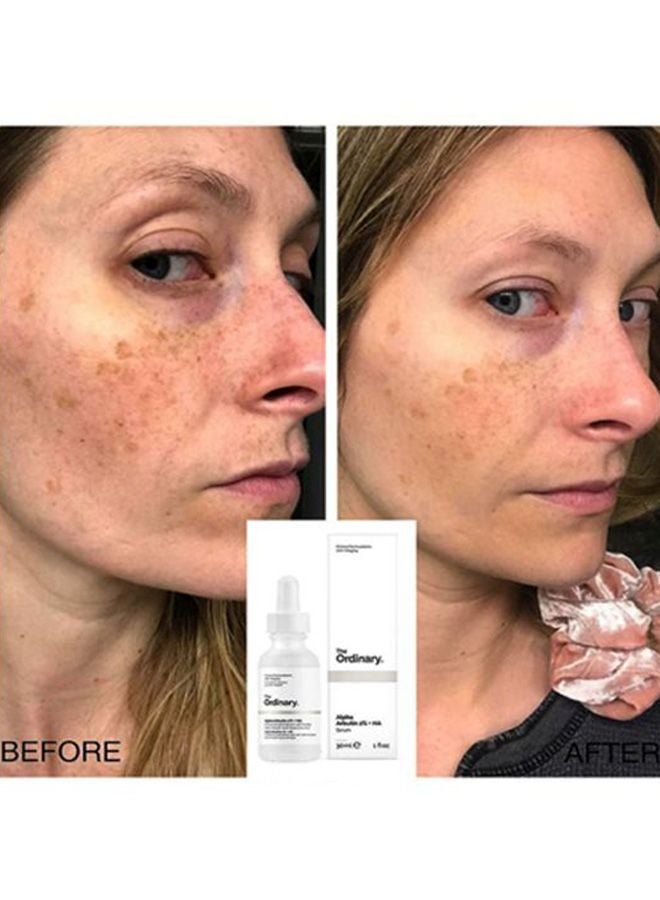 The Ordinary Alpha Arbutin 2% + HA Serum 30ml - Image 5