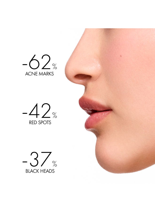 فيشي نورماديرم فيتوسوليوشن مرطب العناية اليومية المزدوج للبشرة الدهنية وحب الشباب مع حمض الساليسيليك 50 مل 50ملليلتر - Image 3