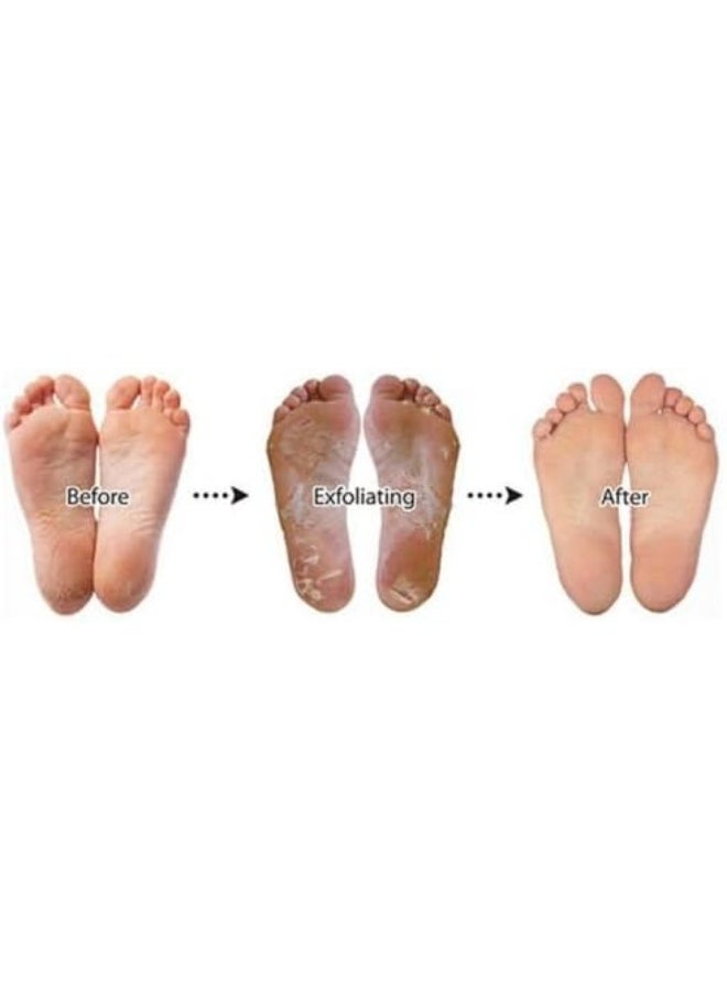 Purederm Exfoliating Foot Mask 40ml  - Image 4