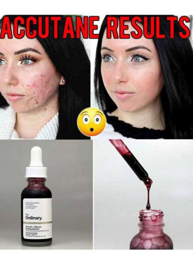 The Ordinary 2-Piece Peeling Solution And Niacinamide 10% Zinc 1% Serum 30ml - Image 5