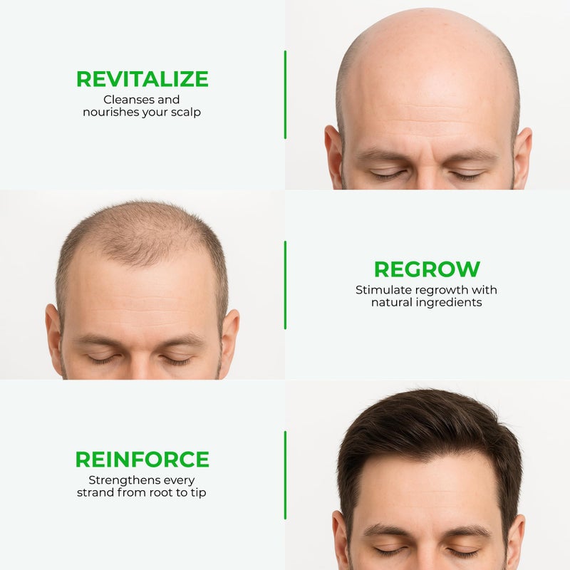 جرين ويلث نيو لوشن للشعر لعلاج تساقط الشعر | إعادة نمو الشعر | ترقق الشعر، البقع الصلعاء وتساقط الشعر | تركيبة موثوقة تحتوي على الجينسنغ، السو بالميتو وحشيشة السرج | 120 مل 120ملليلتر - Image 4