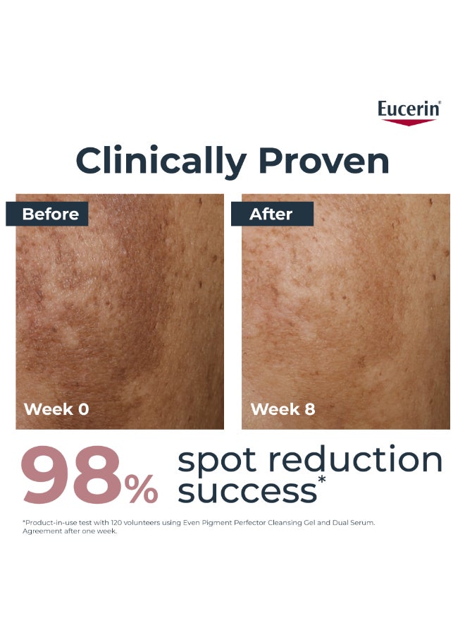 Eucerin - Even Pigment Perfector Dual Face Serum Cream, Reduces Pigment Spots Suitable For All Skin Types 30ml - Image 1