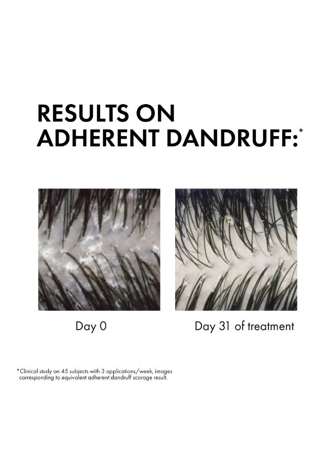 فيشي ديركوس شامبو ضد القشرة للشعر العادي إلى الدهني 200ملليلتر - Image 4