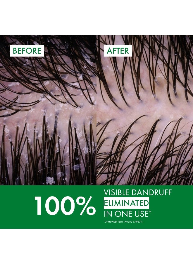 فيشي ديركوس شامبو ضد القشرة للشعر العادي إلى الدهني 200ملليلتر - Image 2