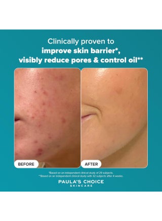 Skin Perfecting 2% BHA Liquid Exfoliant 118ml - view 5
