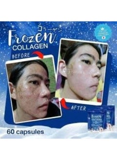 Frozen Collagen 2-in-1 Whitening x10 - pnsku/N49768401A/45/_/1732607193/4a0ef110-e953-41d1-9d18-d7f9c5abf3d2