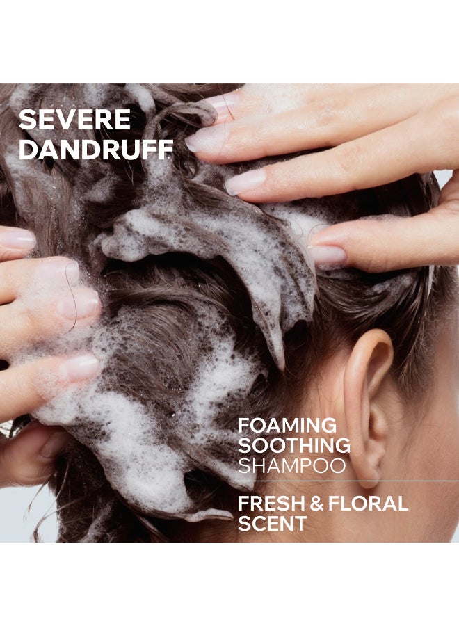 Uriage DS Hair | Anti-Dandruff Purifying Shampoo Piroctone Olamine Cade Oil | For Persistent Flakes And Oily Scalp 150ml - Image 4