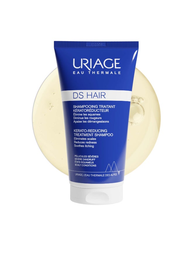 Uriage DS Hair | Anti-Dandruff Purifying Shampoo Piroctone Olamine Cade Oil | For Persistent Flakes And Oily Scalp 150ml - Image 1