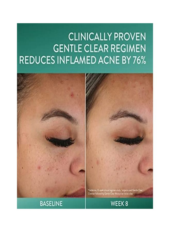 Cetaphil Gentle Clear Clarifying Acne Cream Cleanser Face Wash 124ml - Image 3