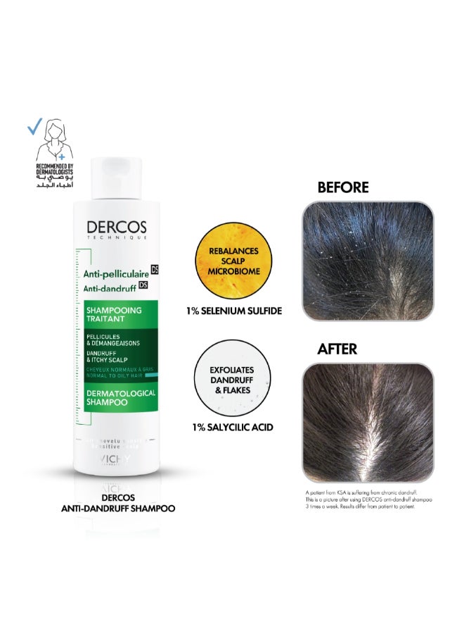 VICHY - Dercos Anti Dandruff Shampoo For Normal To Oily Hair 390ml - Image 1