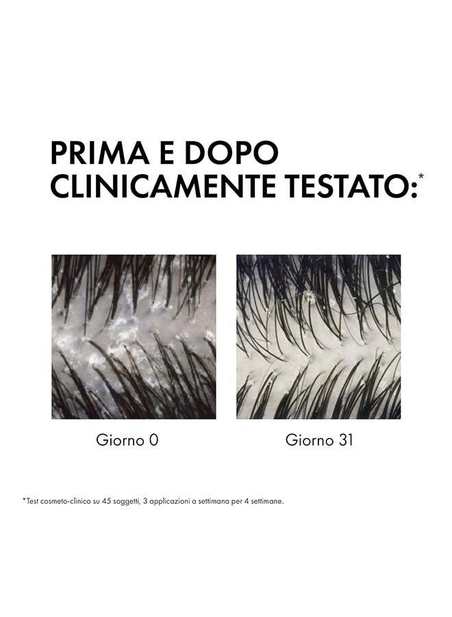 VICHY Dercos Anti-Dandruff Advanced Action Shampoo Normal To Oily Hair 390ml - Image 3