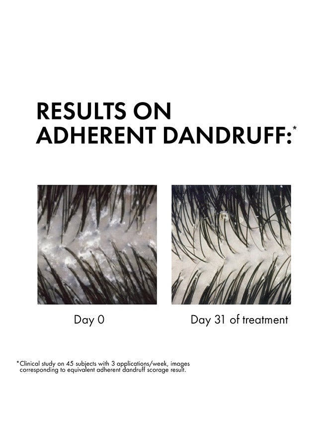 VICHY Dercos Anti-Dandruff Advanced Action Shampoo Normal To Oily Hair 390ml - Image 4