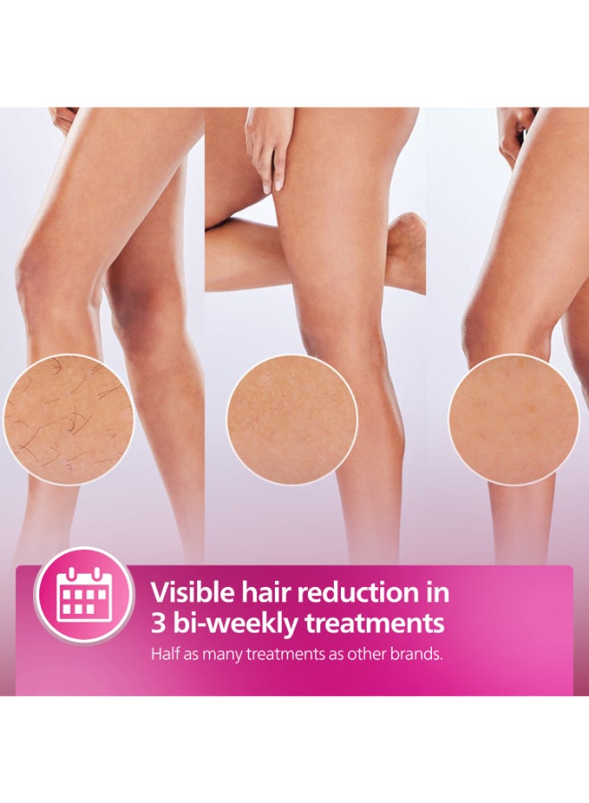 Philips - Philips Lumea IPL, Hair Removal, 8000 Series, Sense IQ Technology, Body Treatment Attachment, Corded Use, BRI940/00, 60 Days Money Back Guarantee White/Silver - Image 1
