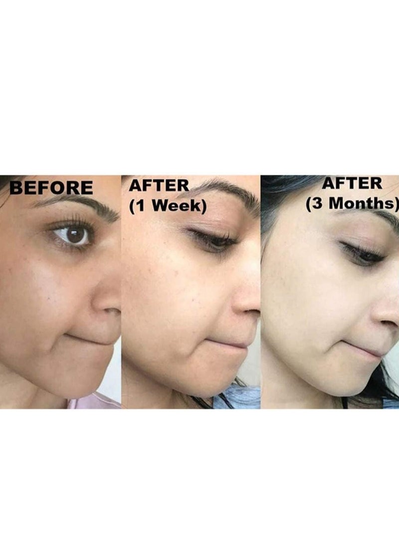 كوجي سان صابون تفتيح البشرة الكلاسيكي لبشرة أفتح وموحدة اللون يحارب البقع الداكنة والندبات وبقع الشيخوخة خالي من الصبغة - Image 5