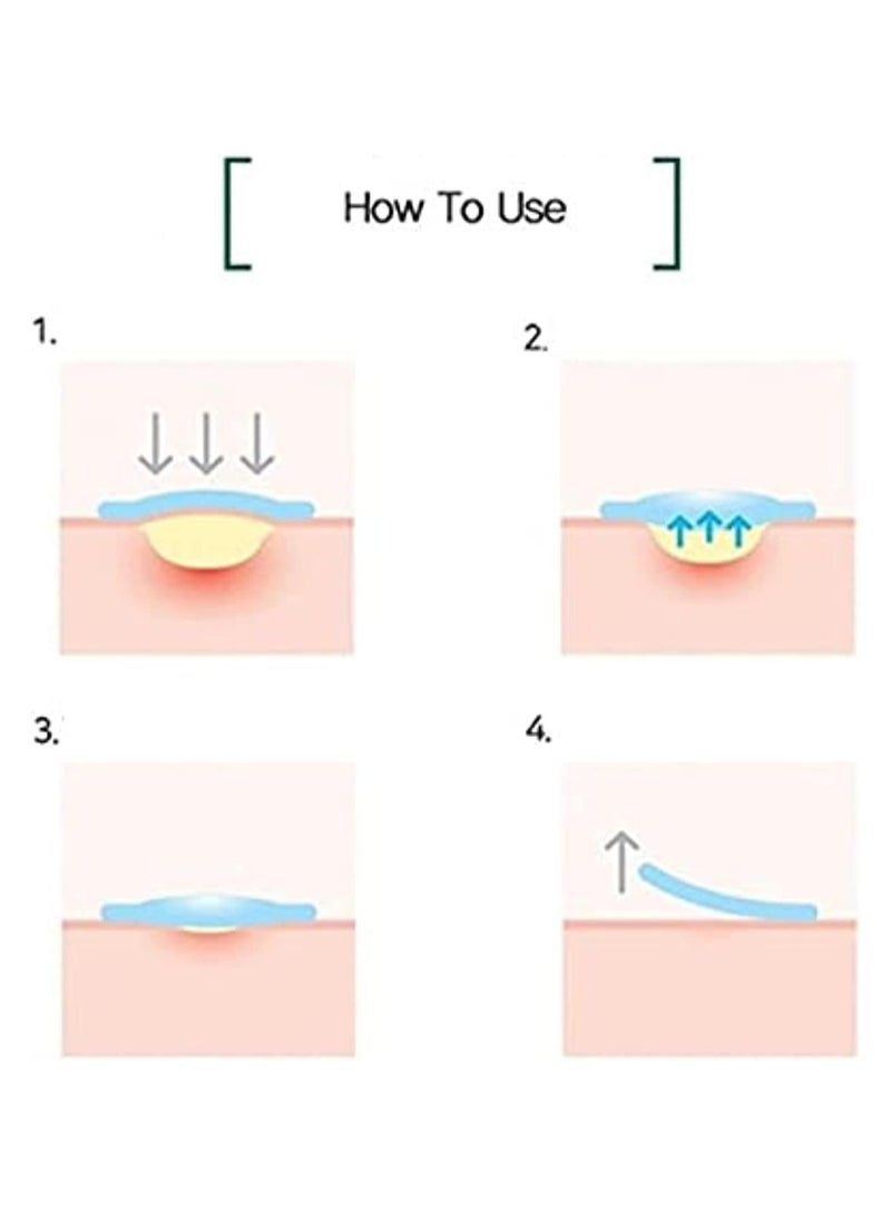Some by Mi 30 Days Miracle Clear Spot Patch, 18 Pieces 0.039centigram  - Image 4