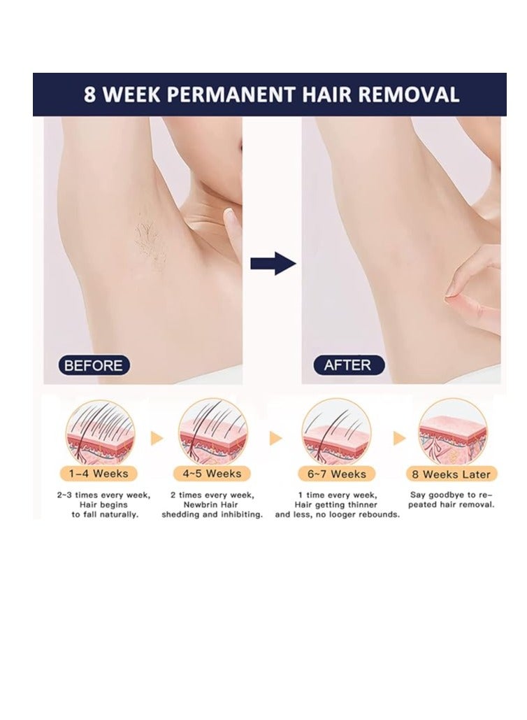 MLAY T14 Hair Removal Device With Three Lenses, One For Body Hair, One For Removing Wrinkles And Tightening The Skin, And One For Removing Acne Dark Blue - Image 4