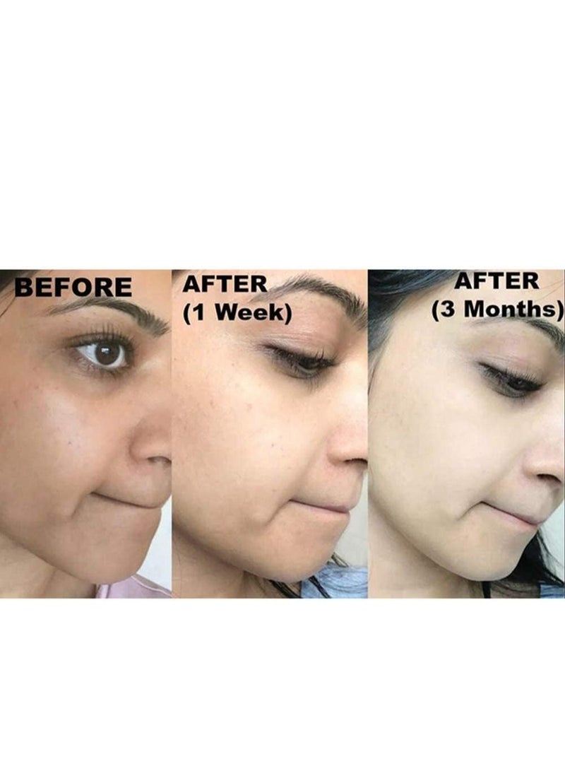 كوجي سان صابون تفتيح البشرة للحصول على بشرة فاتحة وموحدة اللون ومقاومة البقع الداكنة والندبات وبقع الشيخوخة عبوة من قطعتين  - Image 5