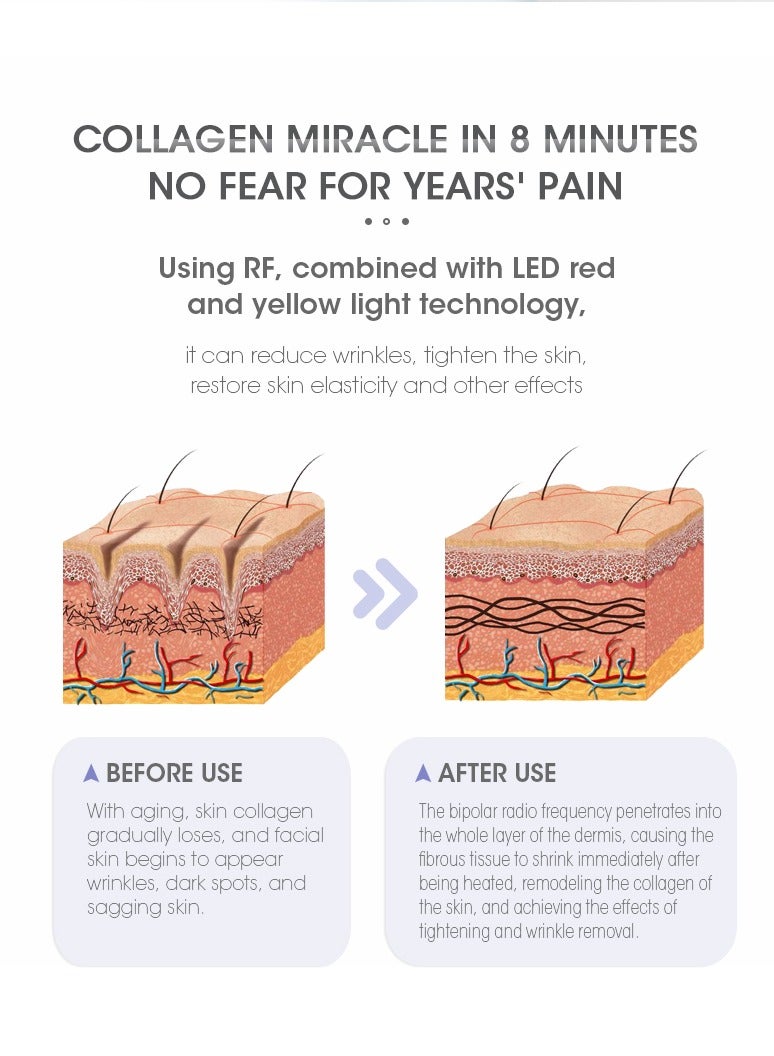 DEESS Rf Ems Skin Care Beauty Device Radio Frequency Anti Aging Instrument Ems Microcurrent Face Lifting Instrument Purple - Image 5