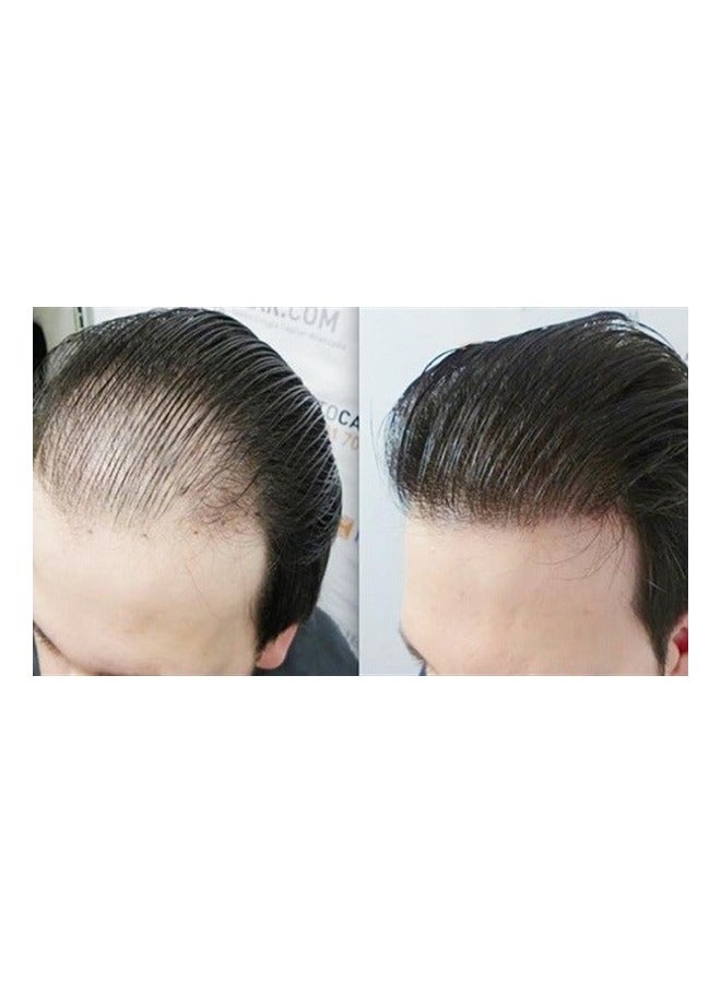 Avalon Pharma Avogen Spray 5% Minoxidil Topical Solution That Prevents Hair Loss And Regrowth 50ml  - Image 3