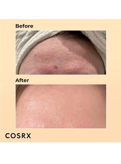 Cosrx Advanced Snail 96 Mucin Power Essence 100ml  - Image 3