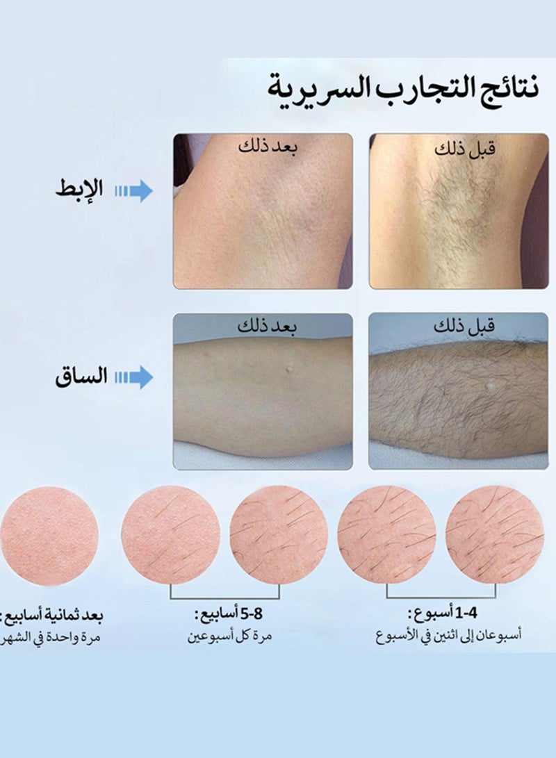 MLAY - T4 IPL Hair Removal Device, At-Home Laser Hair Removal With Ice Cooling, 500,000 Flashes, 5 Energy Levels, Permanent Painless Epilation For Face Back Leg Arm Armpit Bikini Line - Image 1