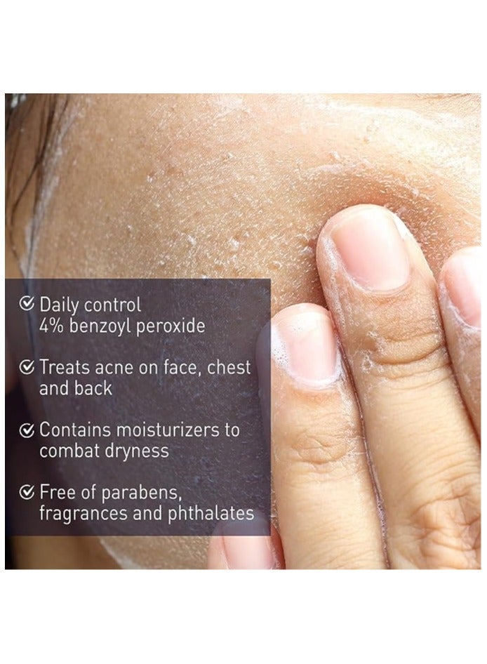 PanOxyl - Acne Creamy Wash, 4% Benzoyl Peroxide 170grams - Image 1