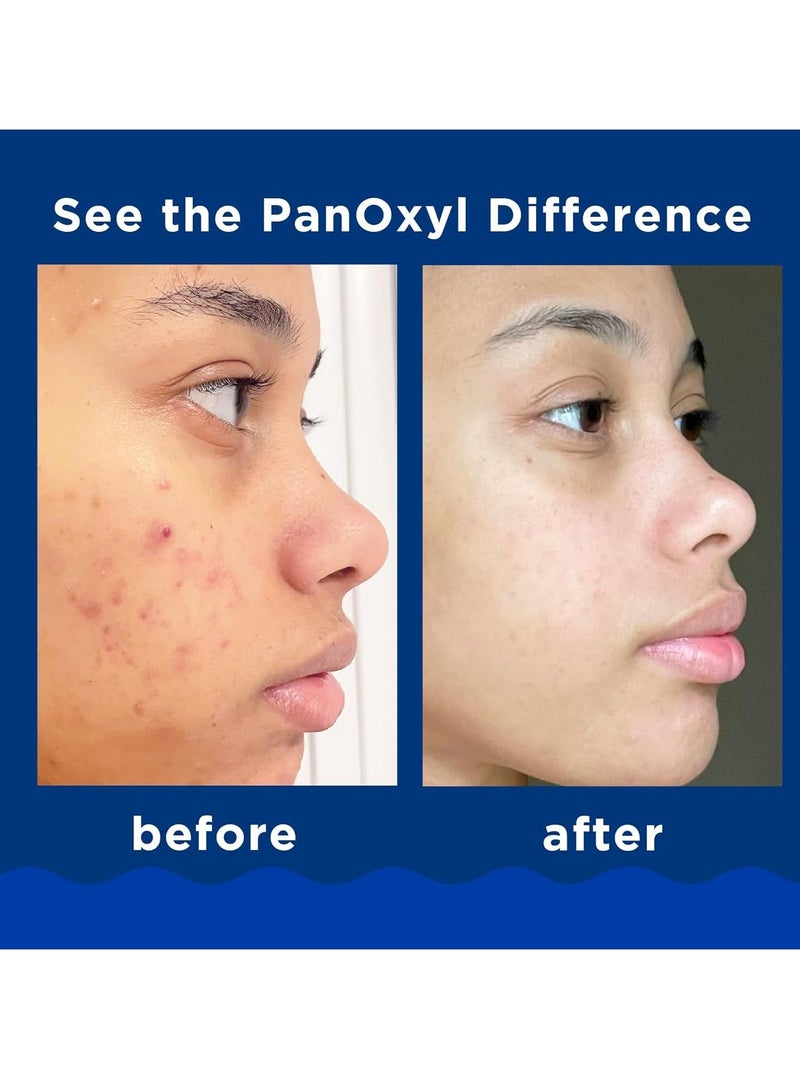 PanOxyl - Benzoyl Peroxide 10% Acne Foaming Wash 156غcentigram - Image 1