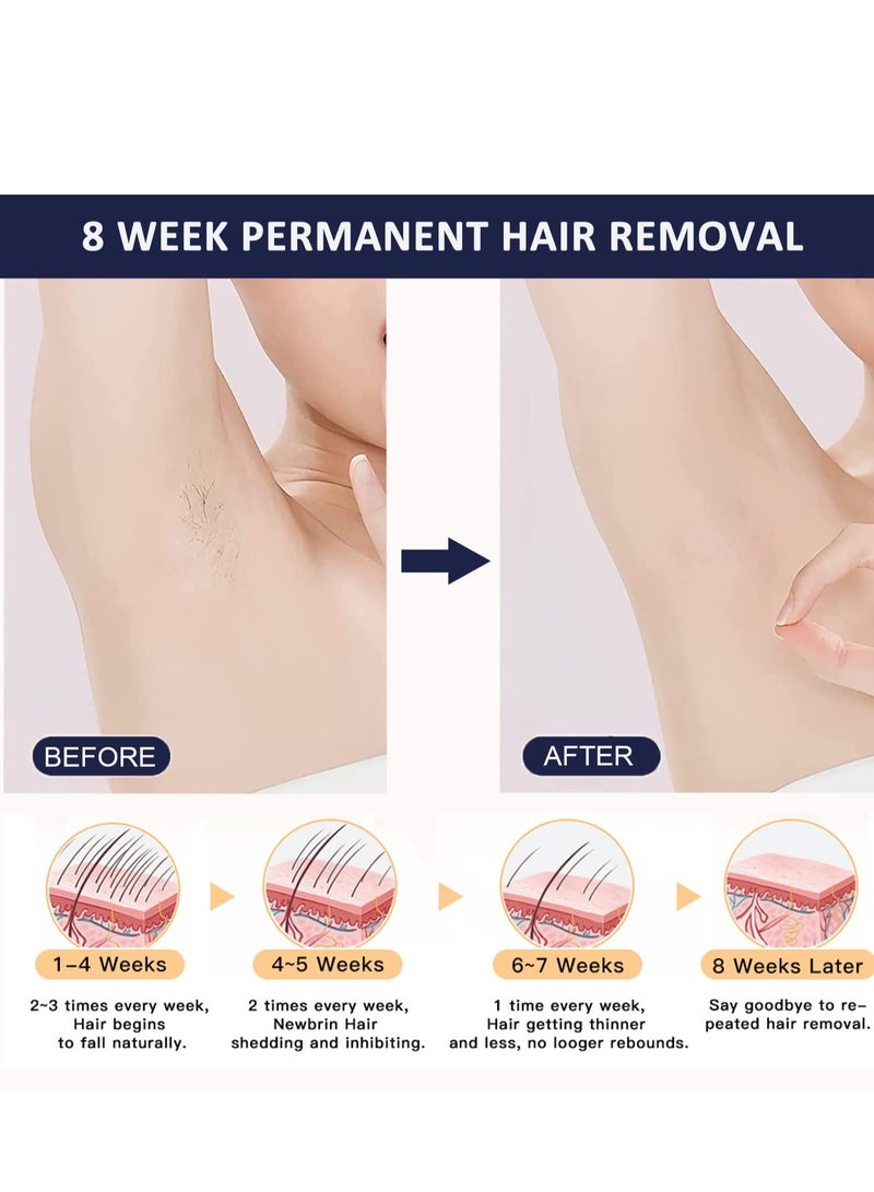 MLAY T14 Laser Painless Fast Hair Removal 3℃ Cold Compress/5-Levels/500000 Pulses Carry An Additional HR Lamp Dark Blue - Image 5