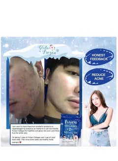 Frozen Collagen 2 In 1 Whitening 10X Premium Collagen Peptide 30000 Mg And L- Glutathione 10000 Mg 60 Tablet - pnsku/N70064584V/45/_/1713942063/d7bfc0fa-8cda-47ac-ae67-69971614bdc4