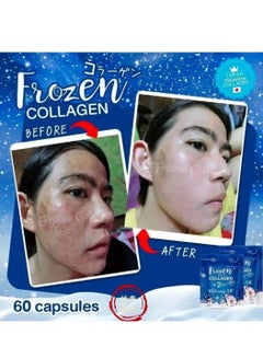 Frozen Collagen 2 In 1 Whitening 10X Premium Collagen Peptide 30000 Mg And L- Glutathione 10000 Mg 60 Tablet - pnsku/N70064584V/45/_/1713942064/104efa52-8f35-4f77-be0f-4c8a5b3c7369