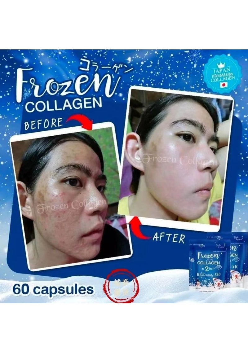 Gluta Frozen - Frozen Collagen 2 In 1 Whitening 10X Premium Collagen Peptide 30000 Mg And L- Glutathione 10000 Mg 60 Tablet - Image 1