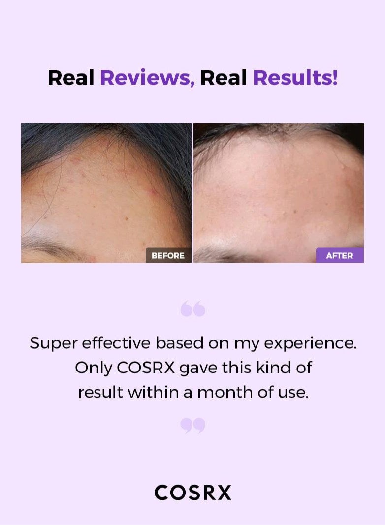 Cosrx AHA/BHA Clarifying Treatment Toner  Facial Exfoliating Spray for Whiteheads Pores & Uneven Skin Korean Toner 150ml  - Image 4