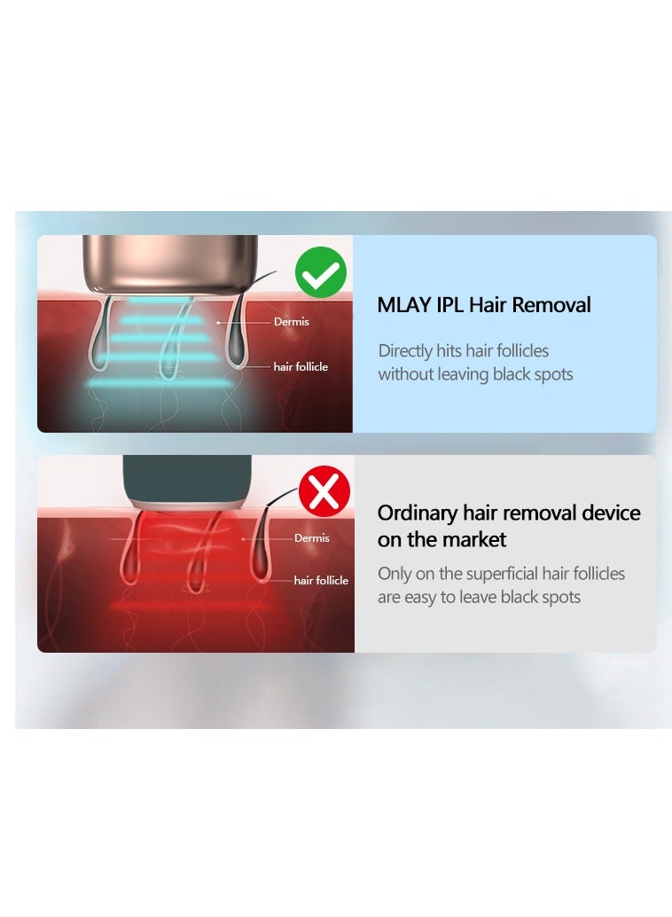 MLAY T14 Painless Ice Compression Epilator Hair Removal Device 3℃ Replaceable Lenses With Bikini Hair Removal Lamp Free Gift Blackhead Remover Dark Blue - Image 2