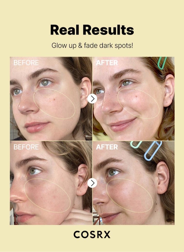 معزز ومرطب ومدلك للوجه Synergy Duo Blemish &amp; Brightening - مصل معزز للبشرة مكون من 6 ببتيدات - مصل فيتامين سي 23 - حلول أصلية معتمدة لمكافحة الشيخوخة لتجديد البشرة - Image 4