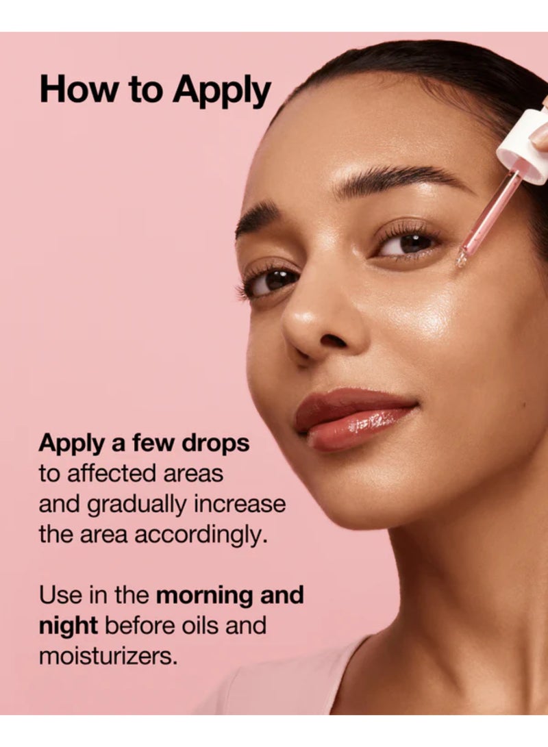 Anua - Niacinamide 10% + Txa 4% Serum 30Ml Packaging May Vary 30 mlml - Image 1