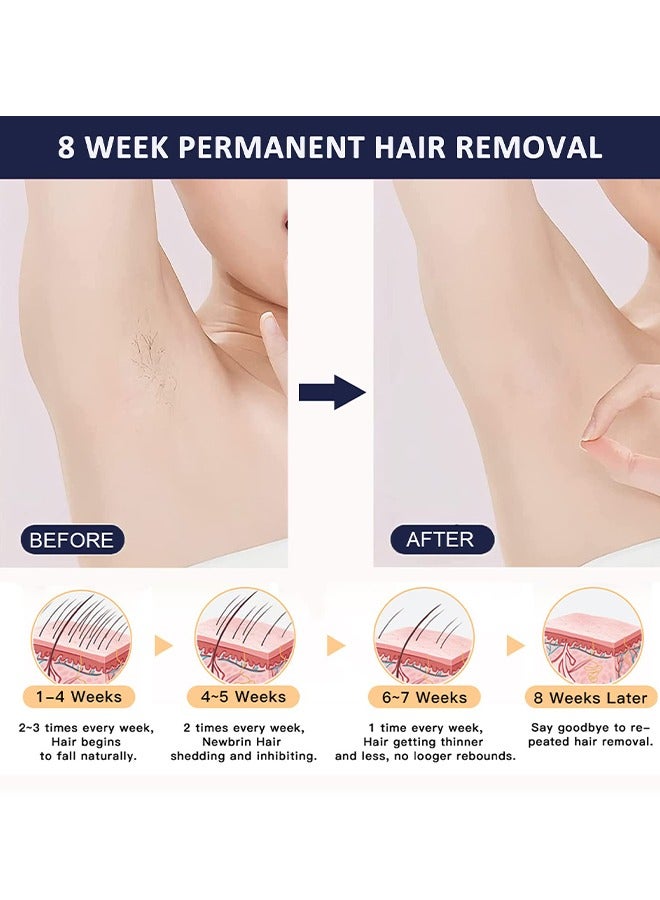 MLAY T14 Laser Painless Fast Hair Removal 3℃ Cold Compress/5-Levels/500000 Pulses Carry An Additional Bikini Lamp And Face Lamp Dark Blue - Image 5