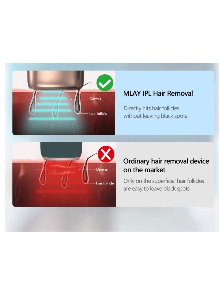 MLAY T14 Painless Ice Compress Laser Hair Removal Device, 500,000 Flashes Epilator For Whole Body Bikini Line Arm Armpit Face Back Leg (2*HR Lamp) Dark Blue - Image 5